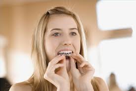 Invisalign : Servicios de Clínica Dental Box Serrano Invisalign : Servicios de Clínica Dental Box Serrano