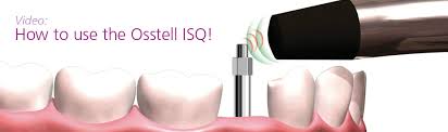 Osstell Mentor: Servicios de Clínica Dental Box Serrano Osstell Mentor: Servicios de Clínica Dental Box Serrano