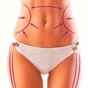 criolipólisis Shambhala Alicante. Anticelulítico Liposucción criolipólisis Shambhala Alicante. Anticelulítico Liposucción