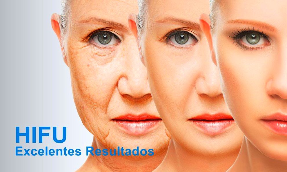 Hifu Alicante Lifting Facial Shambhala Hifu Alicante Lifting Facial Shambhala