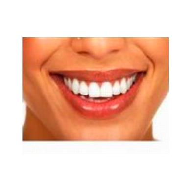Blanqueamiento Dental: Especialidades de Clínicas Dental Máster RJ Alamillo Blanqueamiento Dental: Especialidades de Clínicas Dental Máster RJ Alamillo