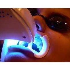 Blanqueamiento dental: Tratamientos de Pies y Manos Blanqueamiento dental: Tratamientos de Pies y Manos