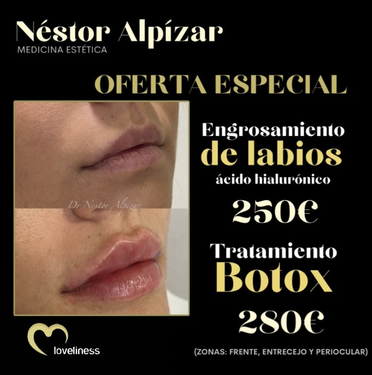 Relleno de ácido hialurónico: Tratamientos de estética de Clínica Estética Loveliness Relleno de ácido hialurónico: Tratamientos de estética de Clínica Estética Loveliness