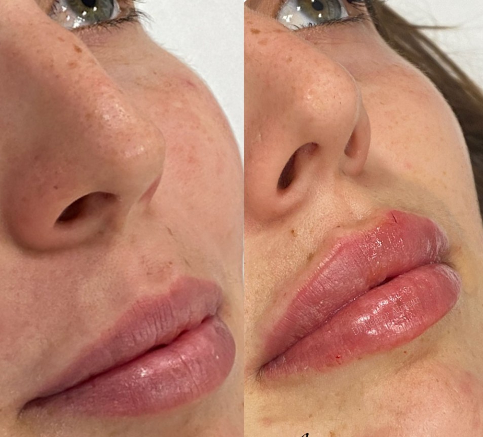 Tratamientos médicos: Tratamientos de estética de Clínica Estética Loveliness Tratamientos médicos: Tratamientos de estética de Clínica Estética Loveliness