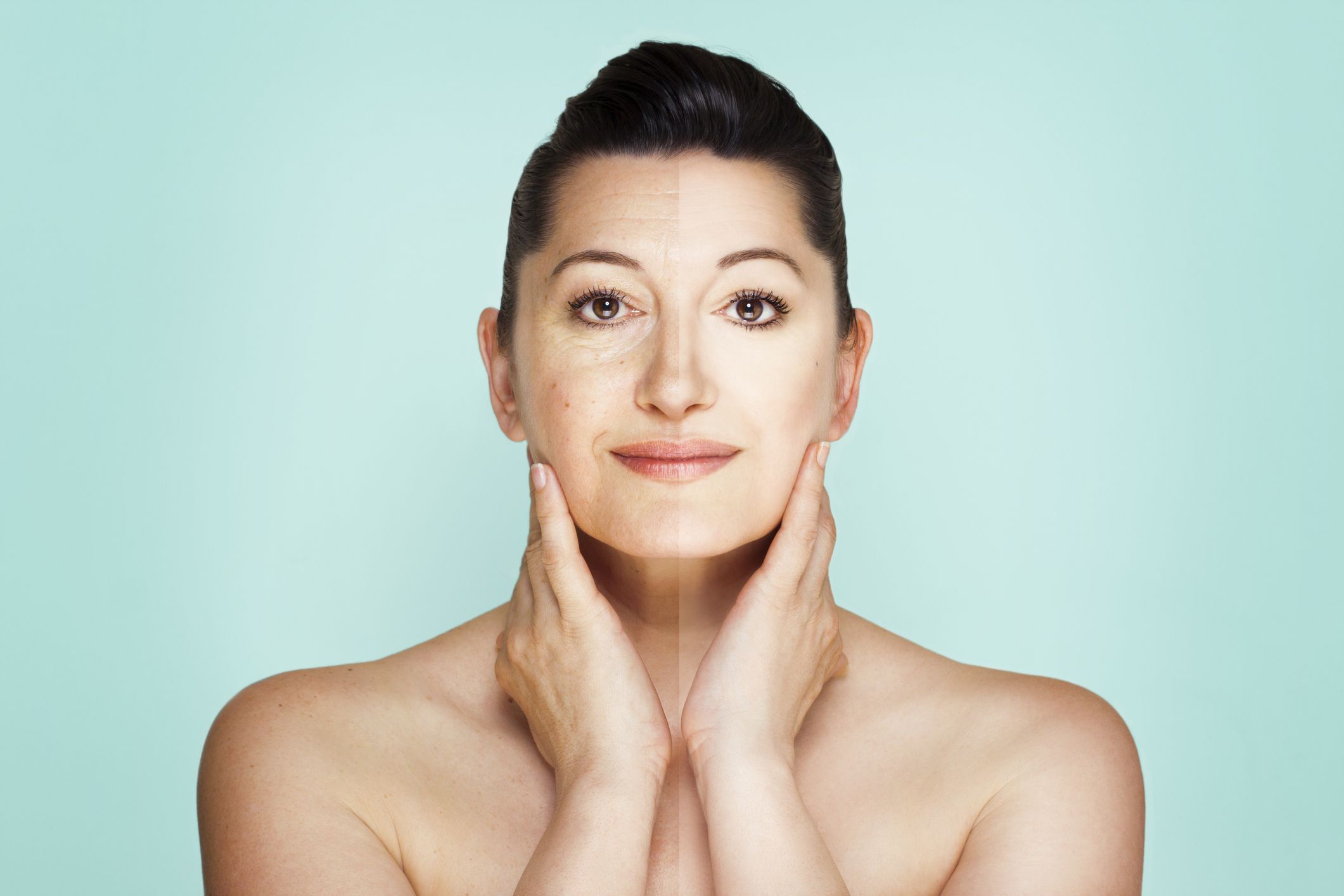 Tratamiento de manchas: Tratamientos de estética de Clínica Estética Loveliness Tratamiento de manchas: Tratamientos de estética de Clínica Estética Loveliness