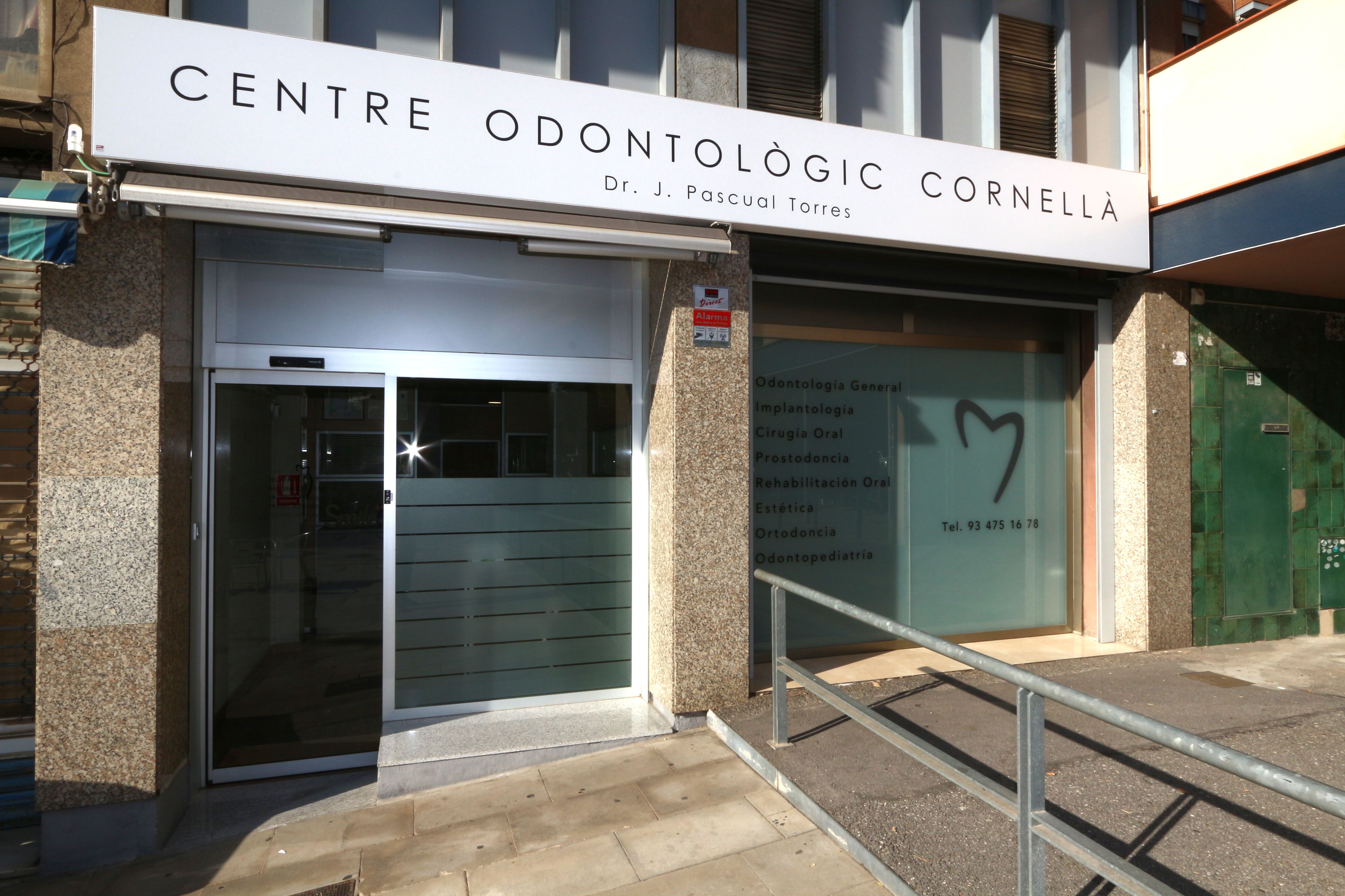 Escáner intraoral: Tratamientos Dentales de Centre Odontologic Cornella Escáner intraoral: Tratamientos Dentales de Centre Odontologic Cornella