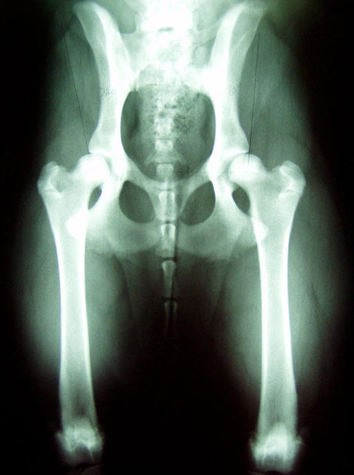 Radiografía de control de displasia de cadera