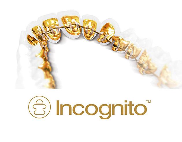 Incognito Incognito