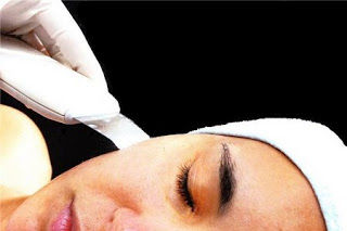 Peeling ultrasonico: Tratamientos de Eterna Belleza Peeling ultrasonico: Tratamientos de Eterna Belleza
