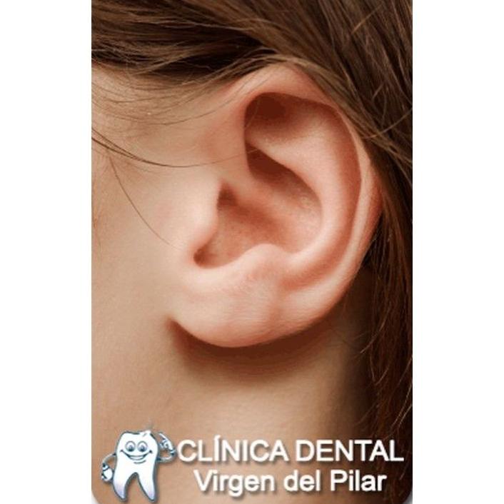 Otoplastias: Tratamientos de Clínica Dental Virgen del Pilar Otoplastias: Tratamientos de Clínica Dental Virgen del Pilar