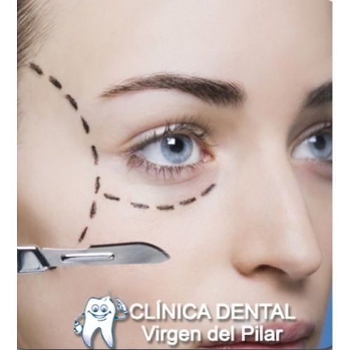 Blefaroplastia: Tratamientos de Clínica Dental Virgen del Pilar Blefaroplastia: Tratamientos de Clínica Dental Virgen del Pilar