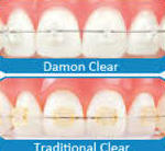 Ortodoncia: Tratamientos de Clínica Dental Miquel Mayordomo Ortodoncia: Tratamientos de Clínica Dental Miquel Mayordomo