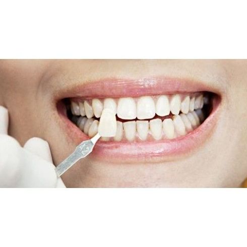 Estética: Tratamientos de Clínica Dental Miquel Mayordomo Estética: Tratamientos de Clínica Dental Miquel Mayordomo