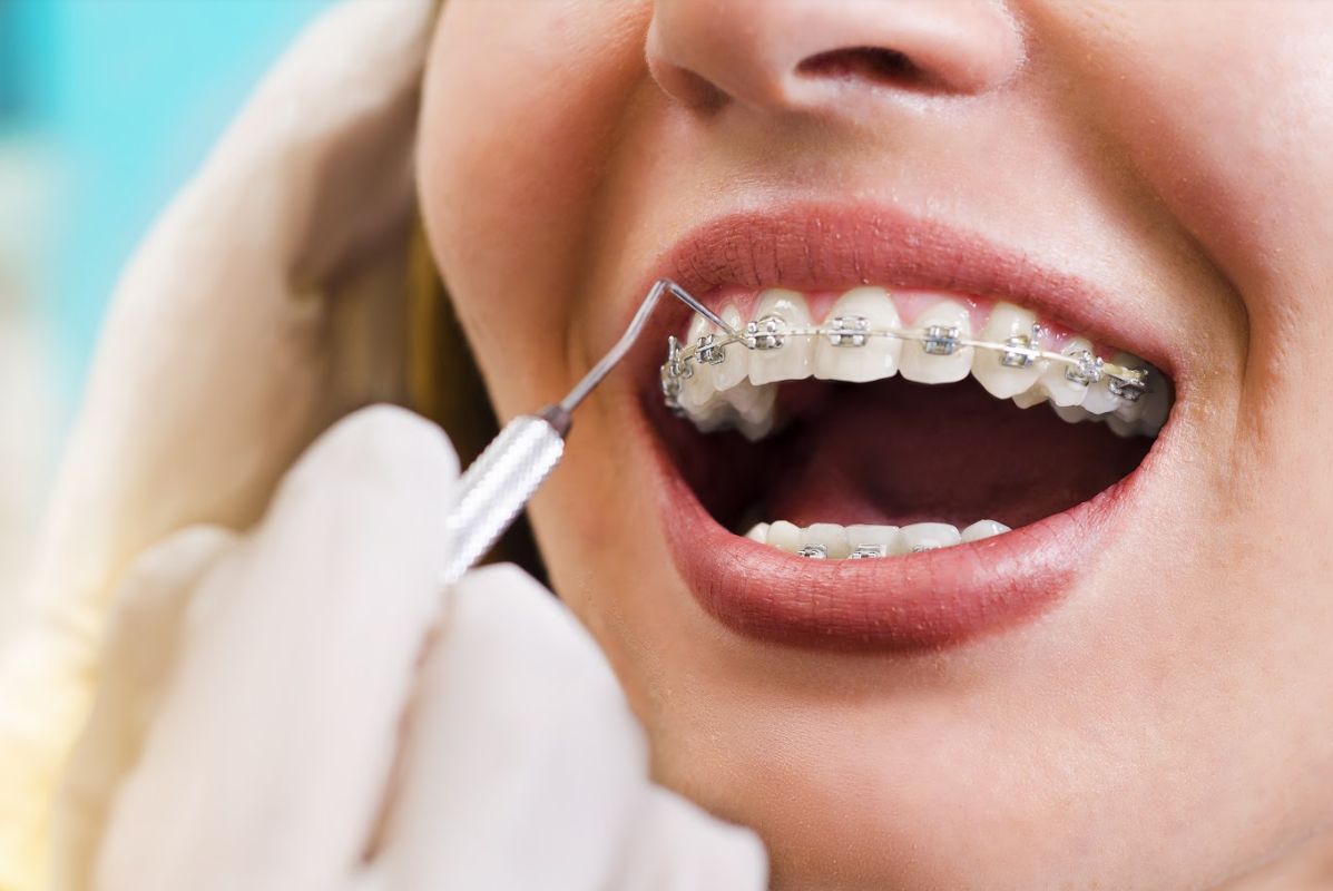 Ortodoncia: Especialidades de Clínica Dental López Rodrigo Ortodoncia: Especialidades de Clínica Dental López Rodrigo