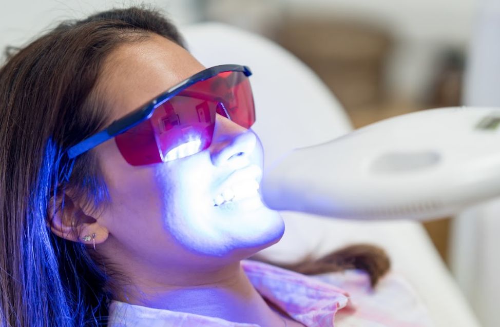 Blanqueamiento dental: Especialidades de Clínica Dental López Rodrigo Blanqueamiento dental: Especialidades de Clínica Dental López Rodrigo