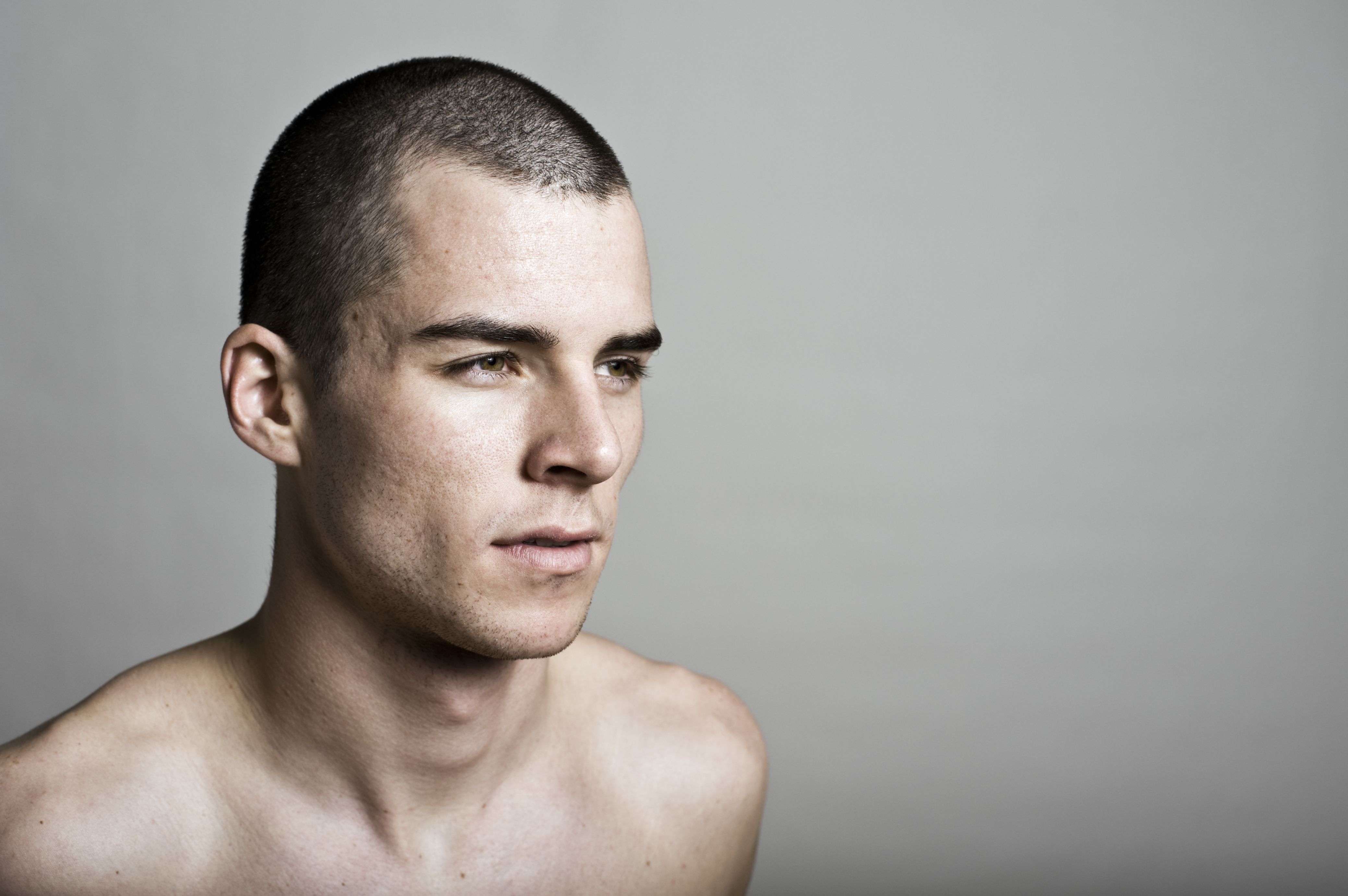 Alopecia hombres: Products de SG Centros capilares y Estética Alopecia hombres: Products de SG Centros capilares y Estética