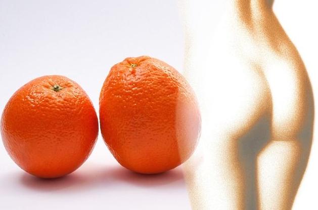 Celulitis y piel de naranja