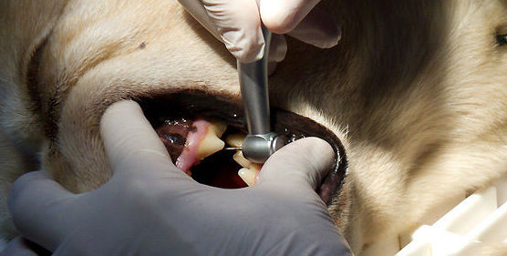 Limpieza dental con ultrasonidos Limpieza dental con ultrasonidos