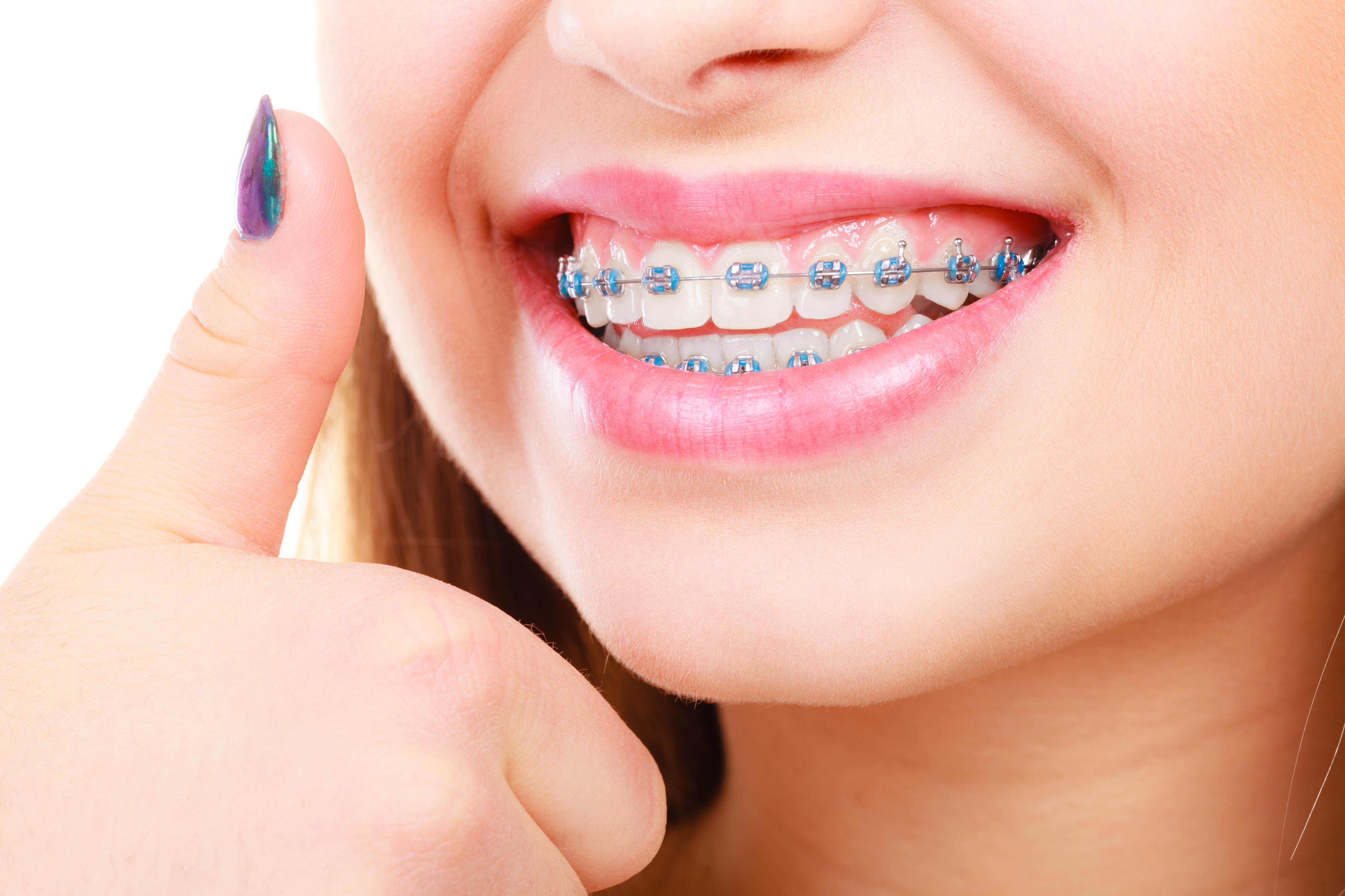 Ortodoncia: Tratamientos de Clínica Dental Del Valle Ortodoncia: Tratamientos de Clínica Dental Del Valle