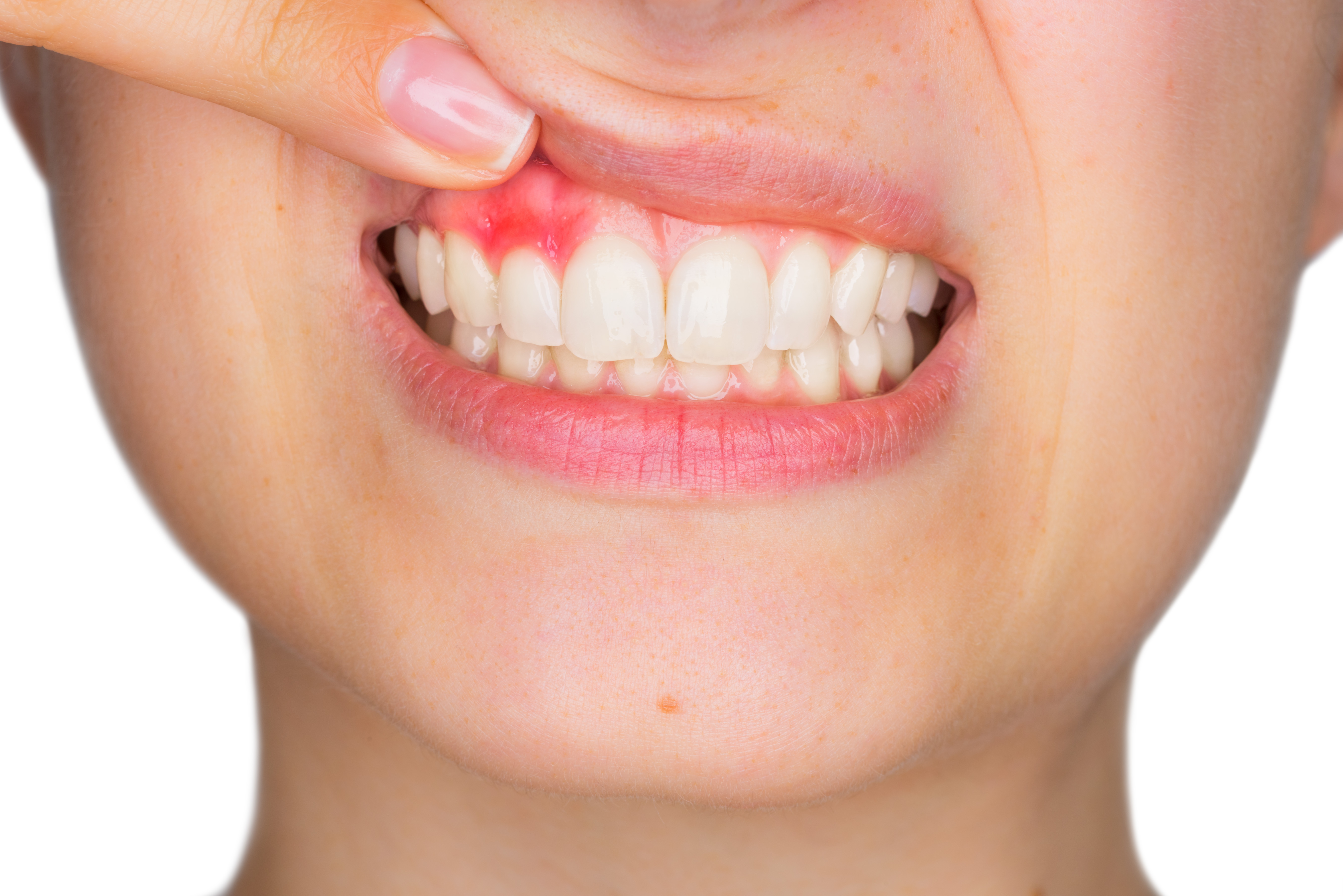 Periodoncia: Tratamientos de Clínica Dental Del Valle Periodoncia: Tratamientos de Clínica Dental Del Valle
