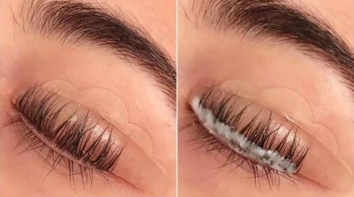 Lifting de pestañas: Servicios y Tratamientos de Neodermal Malaga Lifting de pestañas: Servicios y Tratamientos de Neodermal Malaga