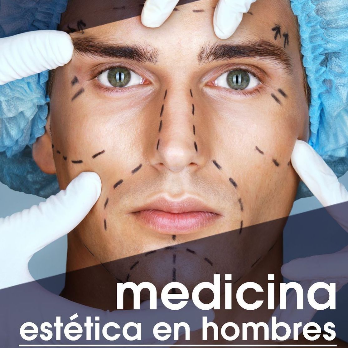 Tratamientos de medicina estética: Servicios y Tratamientos de Neodermal Malaga Tratamientos de medicina estética: Servicios y Tratamientos de Neodermal Malaga