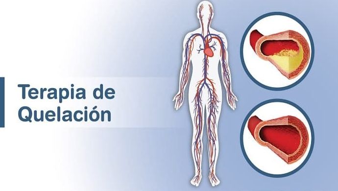Quelatoterapia o sueros metabólicos: Servicios y Tratamientos de Neodermal Malaga Quelatoterapia o sueros metabólicos: Servicios y Tratamientos de Neodermal Malaga