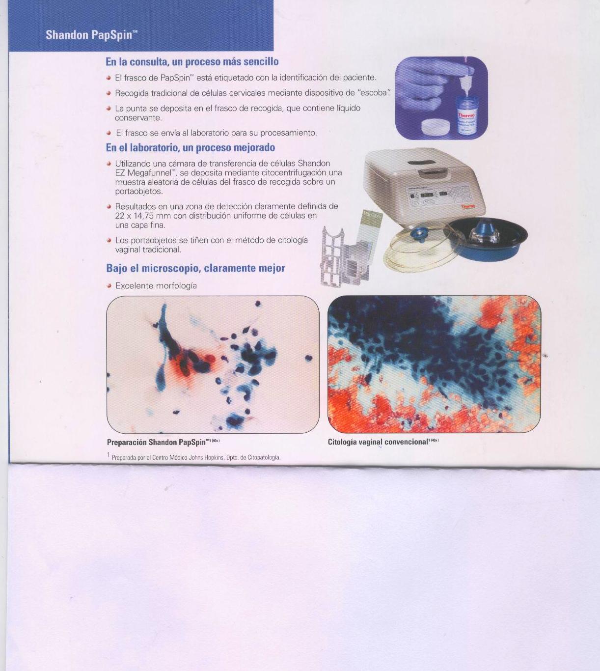 CITOLOGIA EN MEDIO LIQUIDO: Pruebas Diagnósticas de Lasso Diagnósticos ...