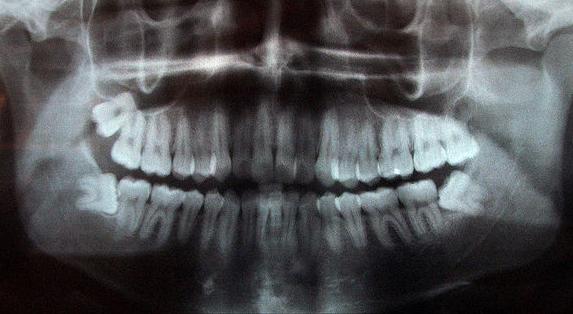 Radiología: Especialidades de Insadent - Centro Odontológico Radiología: Especialidades de Insadent - Centro Odontológico