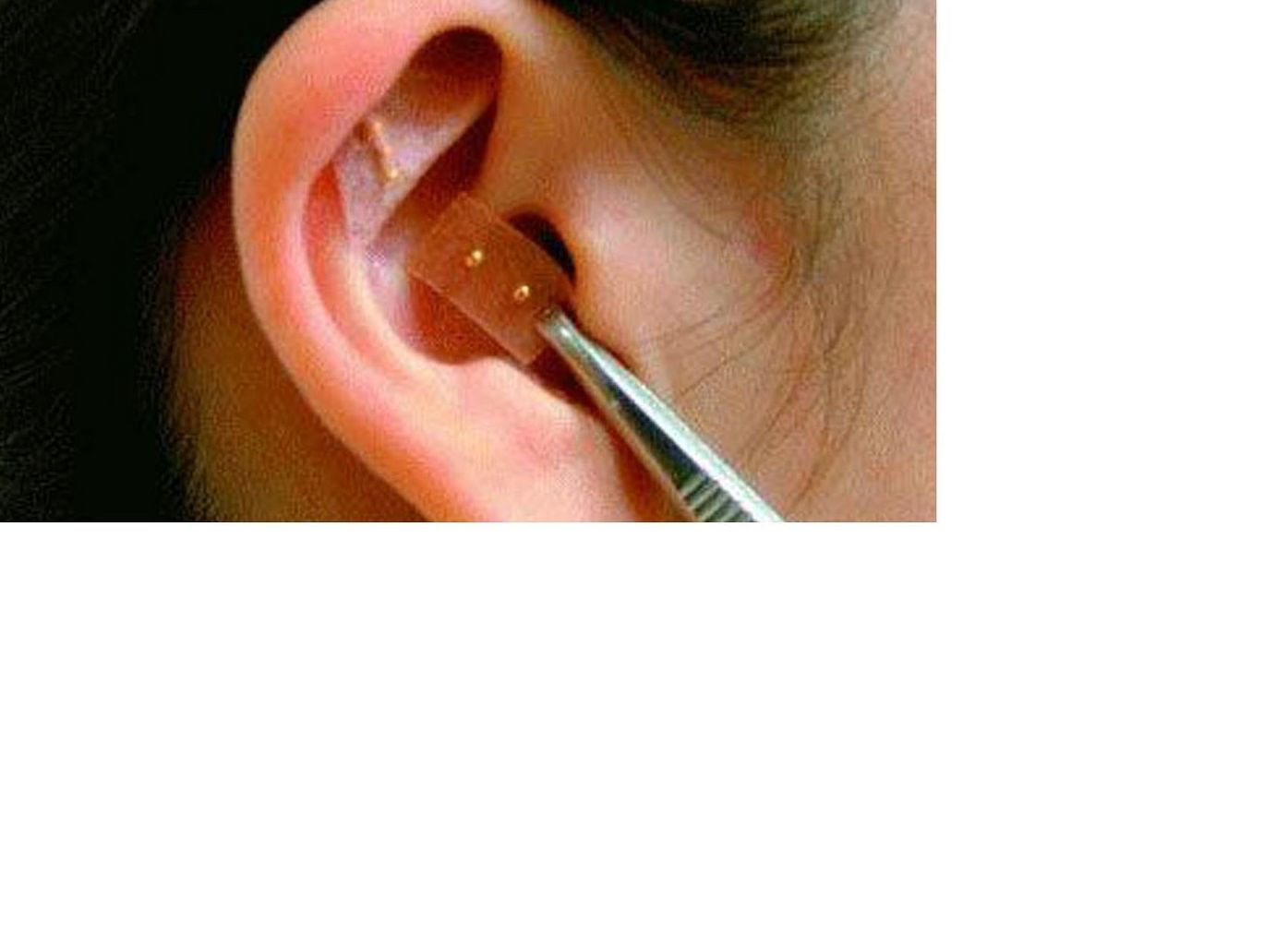 Auriculoterapia: Terapias de Wellnes Avenida Auriculoterapia: Terapias de Wellnes Avenida