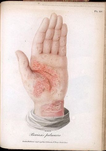 Terapia psicosomática Madrid Terapia psicosomática Madrid