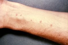 Terapia psicosomática Terapia psicosomática