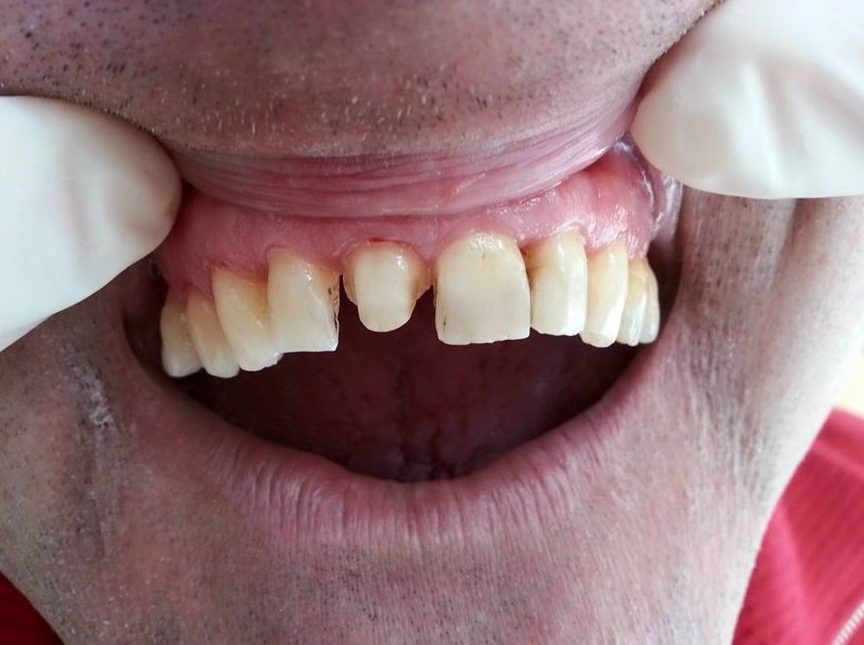 ESTÉTICA Y FUNCIONALIDAD: Catálogo de Policlínica Dental Val de Monterrei ESTÉTICA Y FUNCIONALIDAD: Catálogo de Policlínica Dental Val de Monterrei