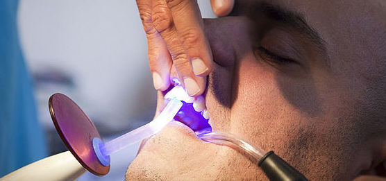 Endodoncia: Tratamientos de Clínica Dental Palamadent Endodoncia: Tratamientos de Clínica Dental Palamadent