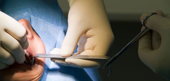 Cirugía bucal: Servicios de Clínica Dental Mataró Cirugía bucal: Servicios de Clínica Dental Mataró