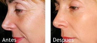Radiofrecuencia Facial : Tractaments i serveis de SILVIA BACHES MINOVES Radiofrecuencia Facial : Tractaments i serveis de SILVIA BACHES MINOVES