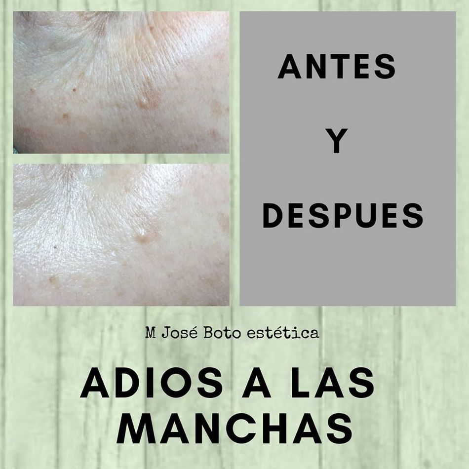 Eliminar manchas 