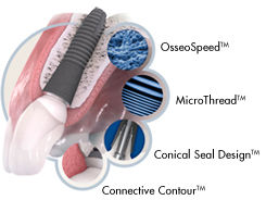 IMPLANTES DENTALES: Clínica dental de Centro Dental Implantológico Dr. Fanjul IMPLANTES DENTALES: Clínica dental de Centro Dental Implantológico Dr. Fanjul