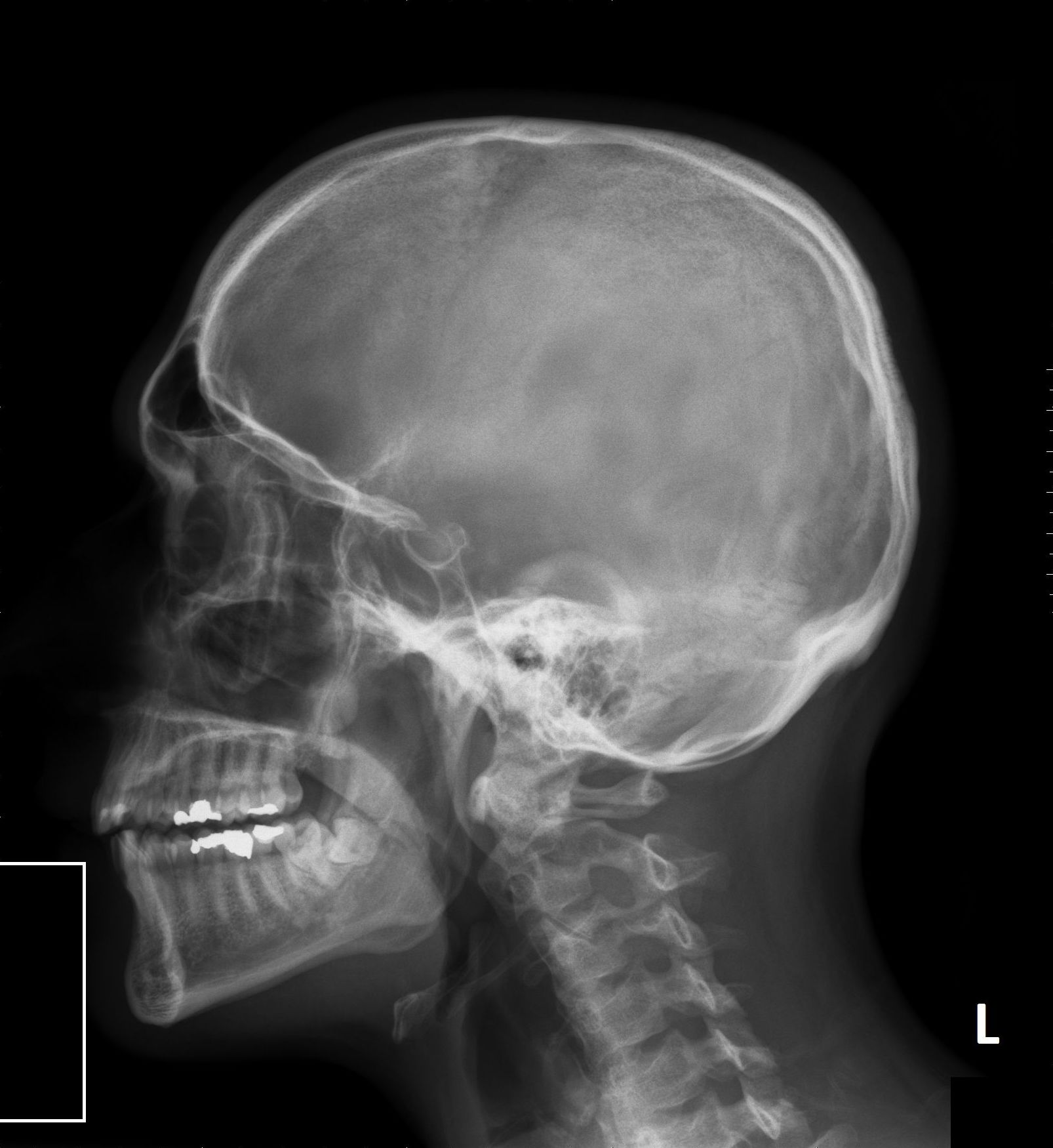 Telerradiografías: Especialidades de Clínica Dental Castellbisbal Telerradiografías: Especialidades de Clínica Dental Castellbisbal