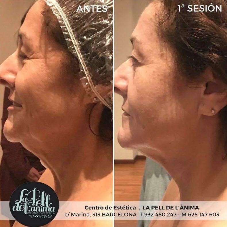 Tratamiento facial Ericson: Tratamientos de La Pell de L'ànima Tratamiento facial Ericson: Tratamientos de La Pell de L'ànima