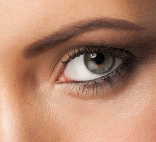 Blefaroplastia Blefaroplastia