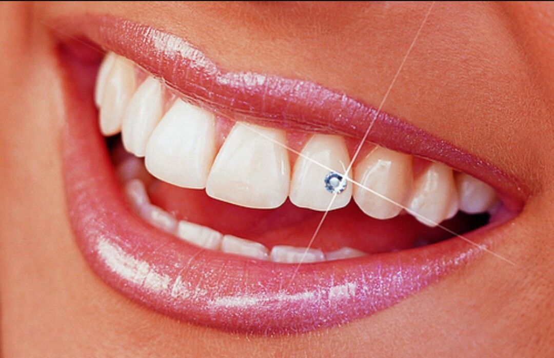 Brillante dental: Servicios de Clínica Dental Lau Hagin Brillante dental: Servicios de Clínica Dental Lau Hagin