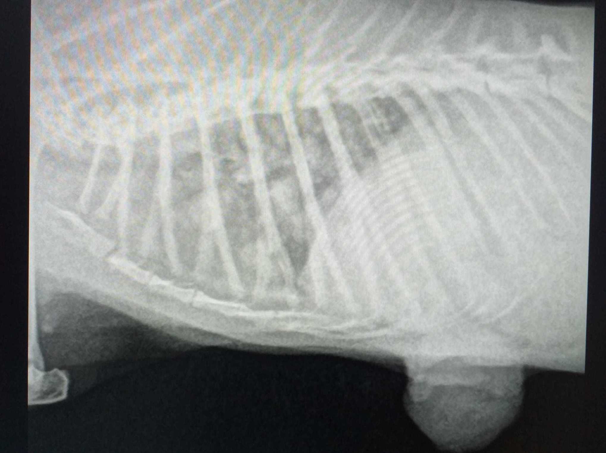RX cáncer en pulmón. RX cáncer en pulmón.