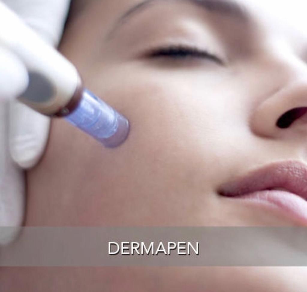mesoterapia facial con Dermapen mesoterapia facial con Dermapen
