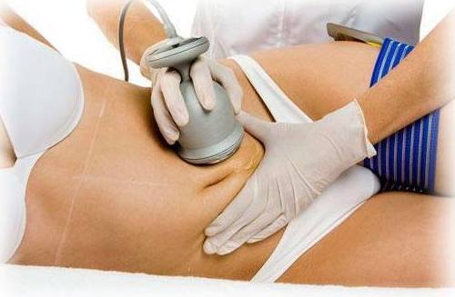 Cavitación: Servicios de Divinity Body Nails Cavitación: Servicios de Divinity Body Nails