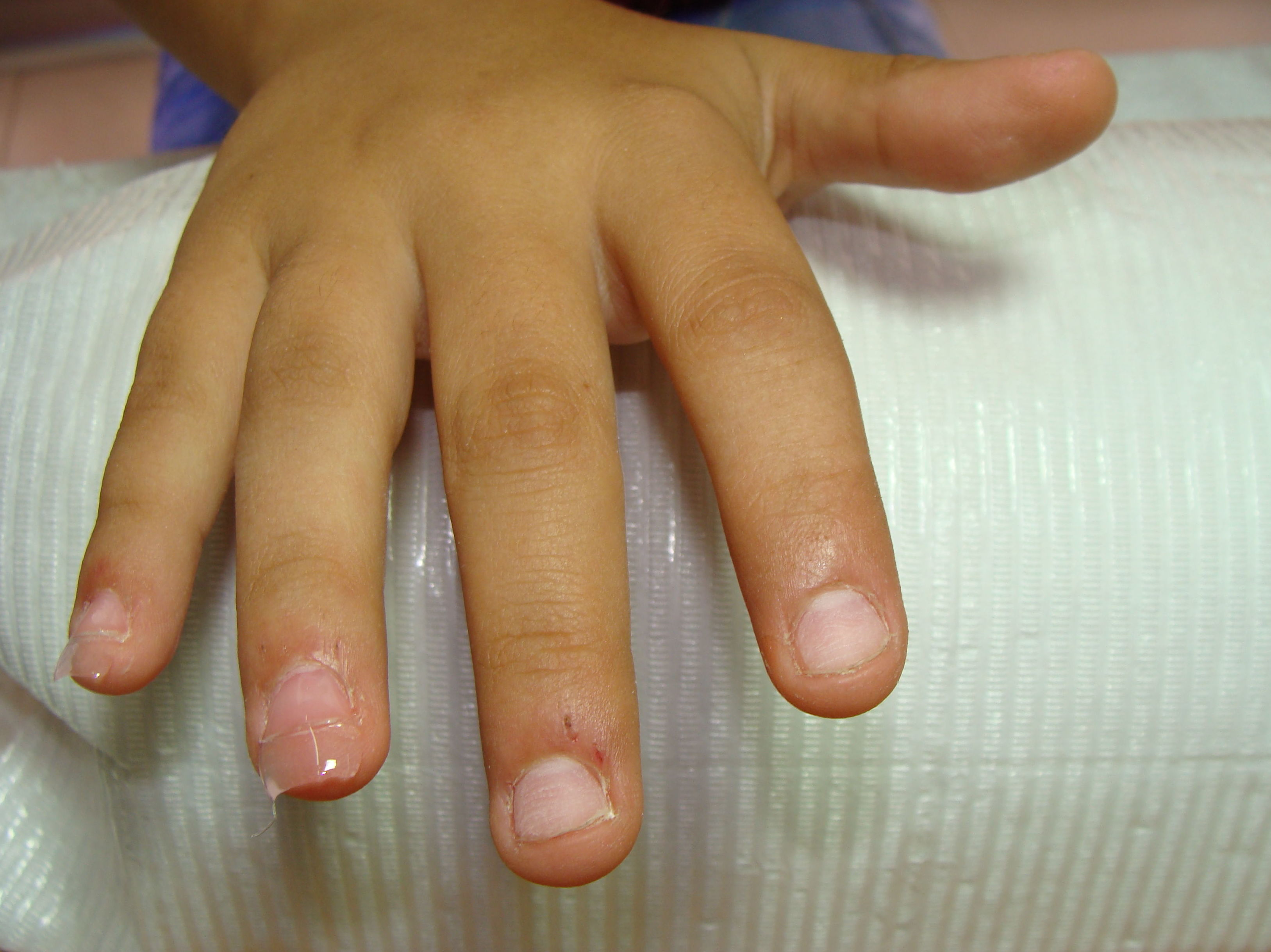 Uñas Mordidas: Servicios de Divinity Body Nails Uñas Mordidas: Servicios de Divinity Body Nails