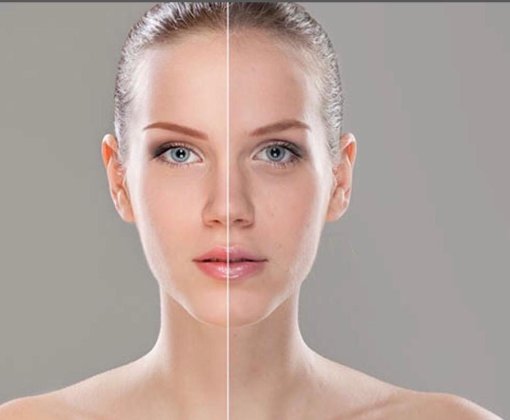 BB Glow Facial: Efecto flash duradero: Servicios de Divinity Body Nails BB Glow Facial: Efecto flash duradero: Servicios de Divinity Body Nails