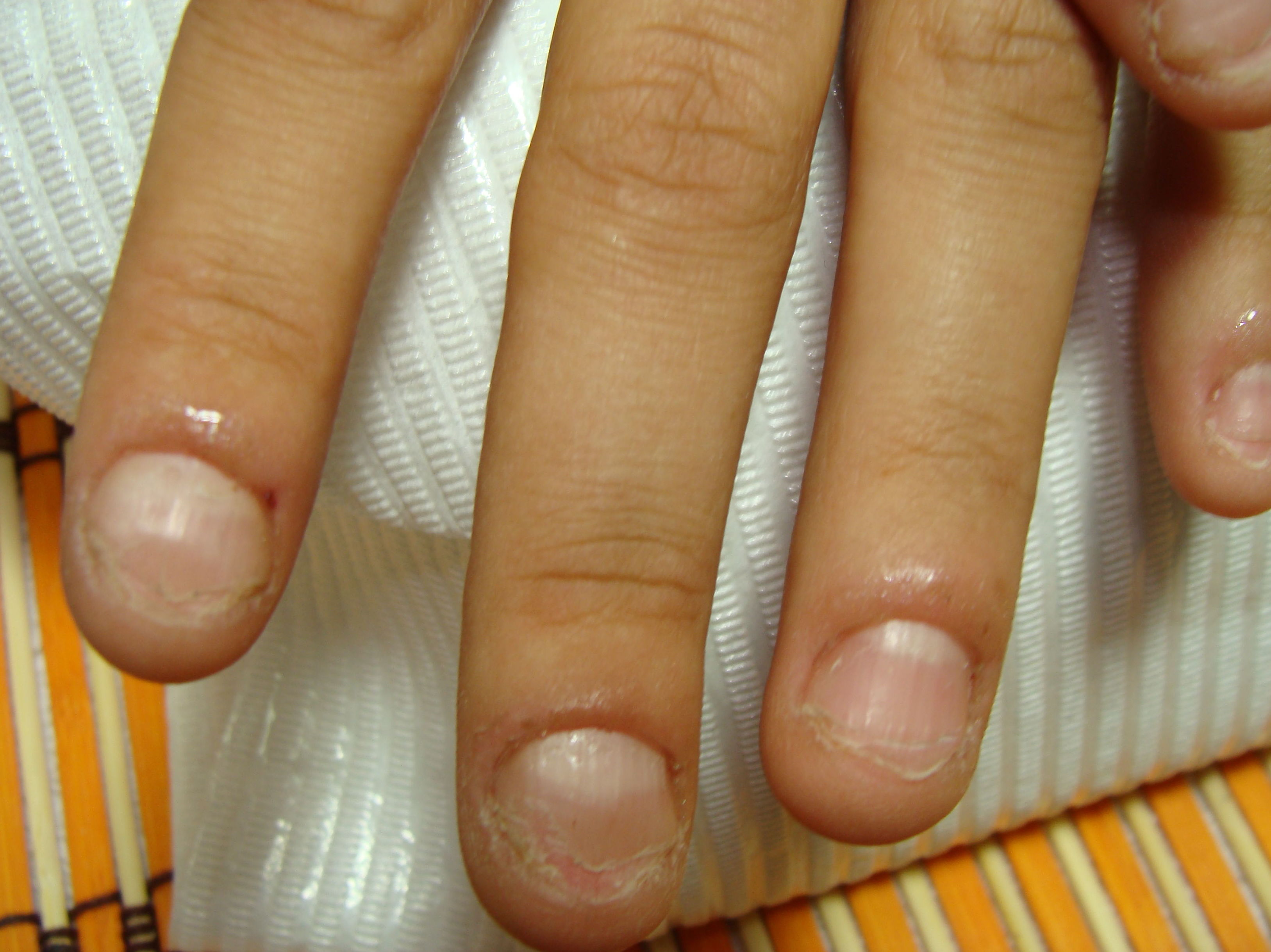 Uñas Mordidas: Servicios de Divinity Body Nails Uñas Mordidas: Servicios de Divinity Body Nails