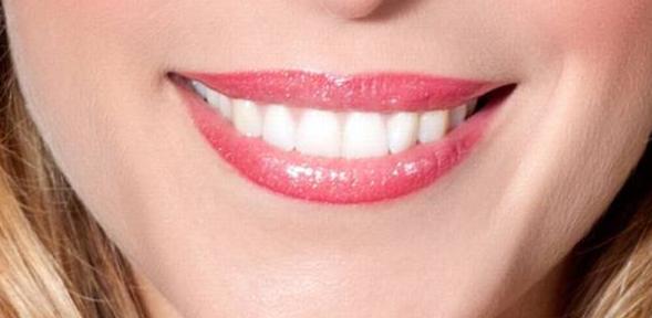 Estética dental: Servicios de Clínica Dental Dra. Amparo Magraner Estética dental: Servicios de Clínica Dental Dra. Amparo Magraner