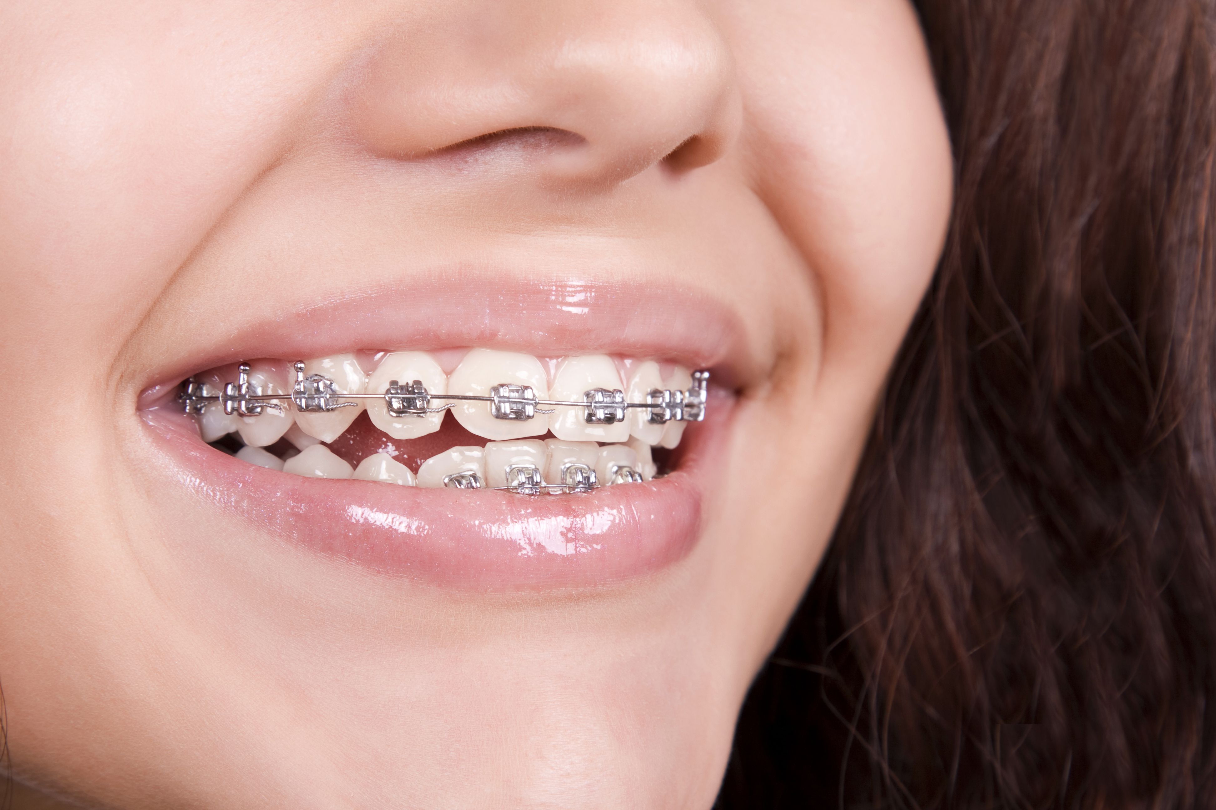 Ortodoncia: Servicios de Clínica Dental Dra. Amparo Magraner Ortodoncia: Servicios de Clínica Dental Dra. Amparo Magraner